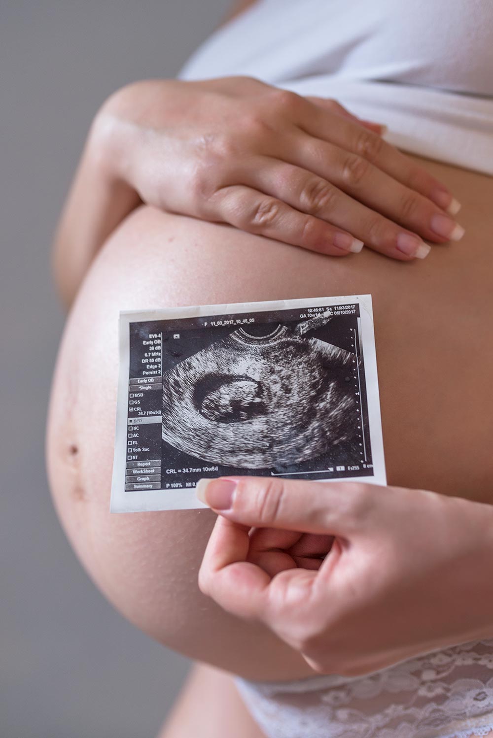 pregnant-woman-holding-photo-of-future-baby pregnant-woman-holding-photo-of-future-baby